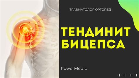 Эффективное лечение сильных болей в плечевом суставе